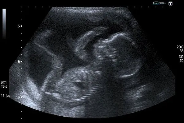 Leading US bishop: 2016 is the time for pro-life conscience protections