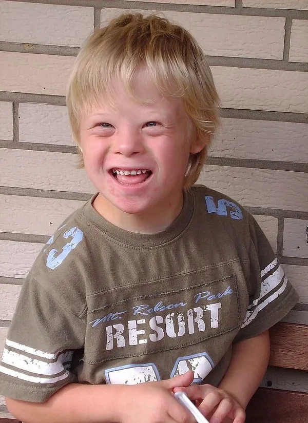 How To Get Rid of Down Syndrome