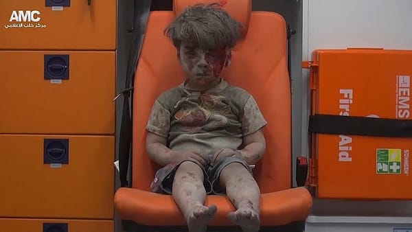 Syria’s continuing humanitarian disaster seen in child’s face