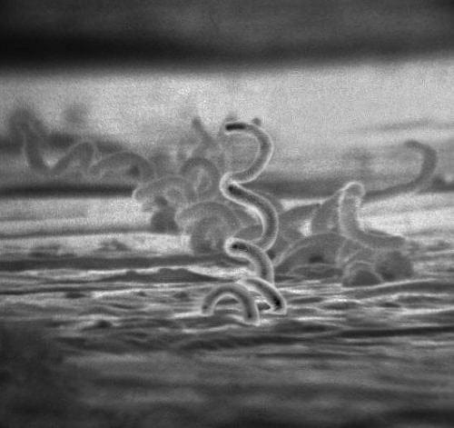 Syphilis Way Up In Maine