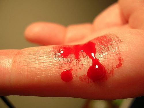 Blood Discussion in Biology Class Leads Three Students To Faint